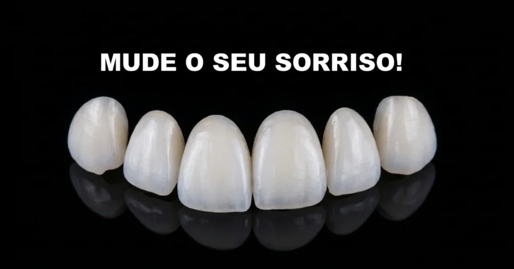 Facetas de porcelana